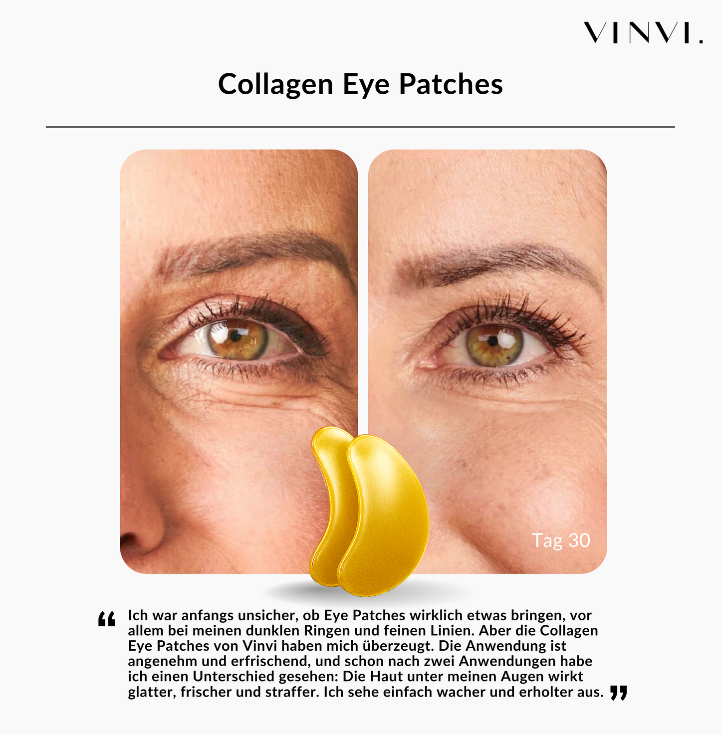 BIO COLLAGEN EYE PATCHES | FÜR EINE SICHTBAR FRISCHE HAUT UNTER DEN AUGEN | 1+1 GRATIS