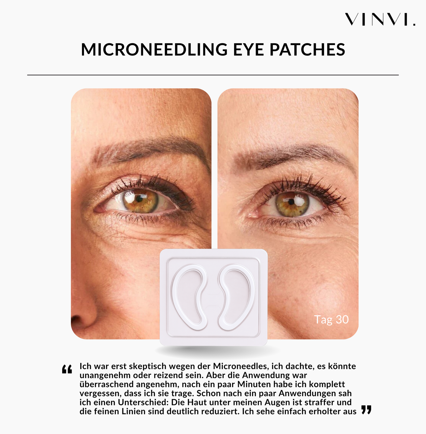 MICRONEEDLING EYE PATCHES | GLATTE, STRAHLENDE AUGENPARTIE