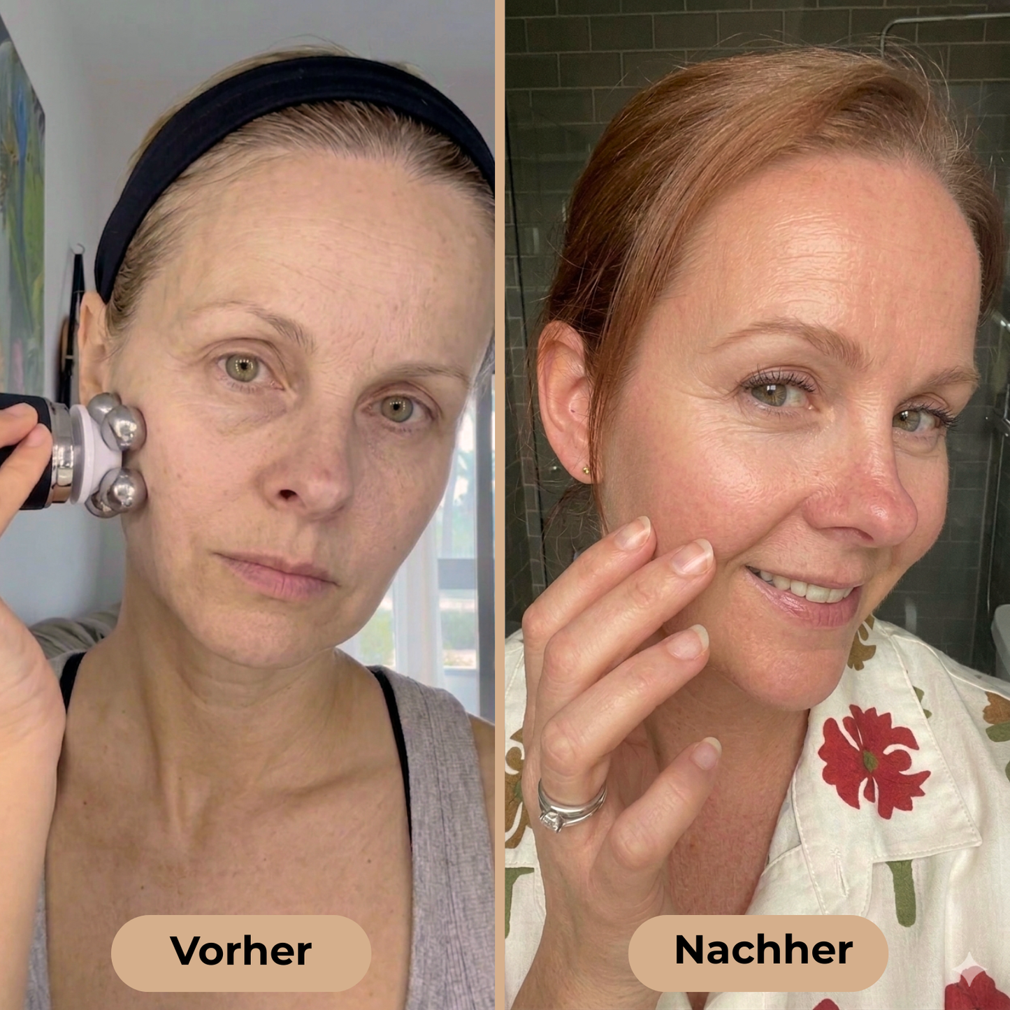 DERMAGLOW | FÜR STRAHLENDE UND GESUNDE HAUT